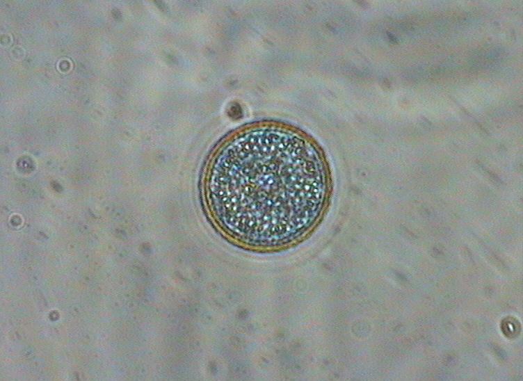 Dictyocha speculum